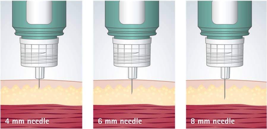 NeedleLength.jpg